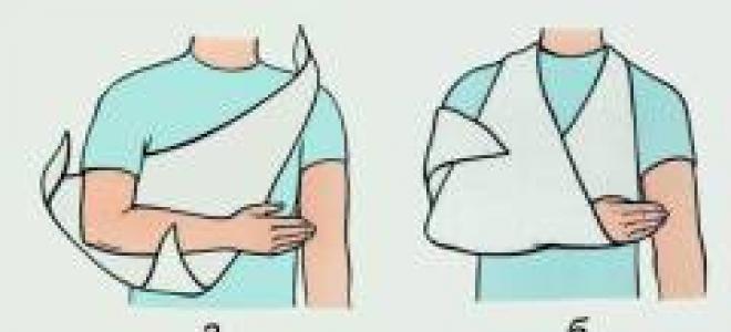 Schulterluxation – Behandlung ohne Operation zu Hause